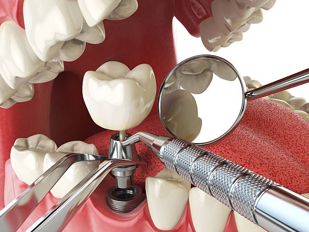 Best Knocked-Out Tooth Emergency  in Jefferson, LA